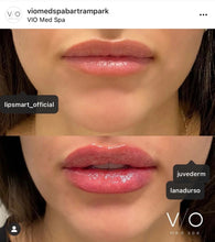 Load image into Gallery viewer, LipSmart® Powerful Hydration for Dry Lips