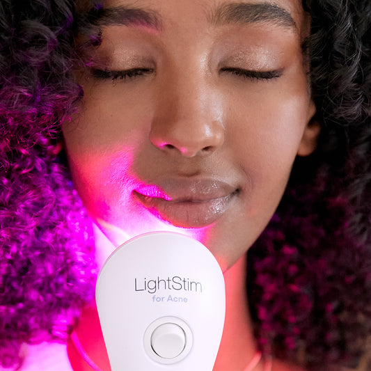 LightStim Anti-Acne Device