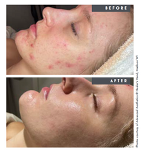 Load image into Gallery viewer, Clarity+ Kit