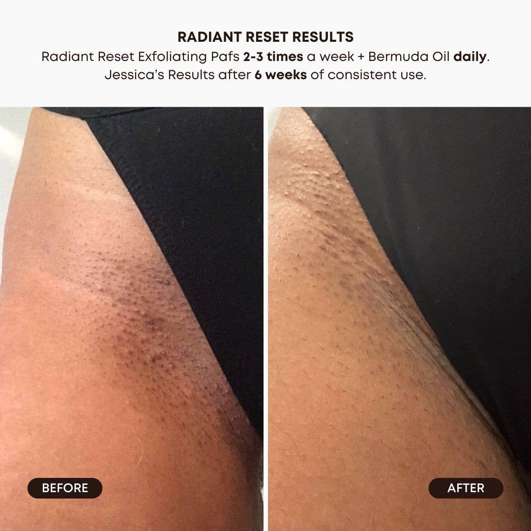 Radiant Reset Exfoliating Toner Pads (30)