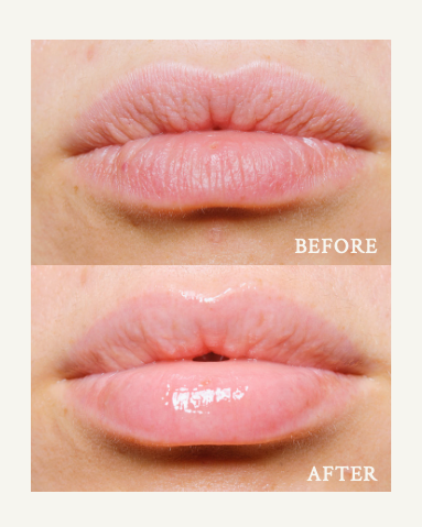 LipSmart® Powerful Hydration for Dry Lips