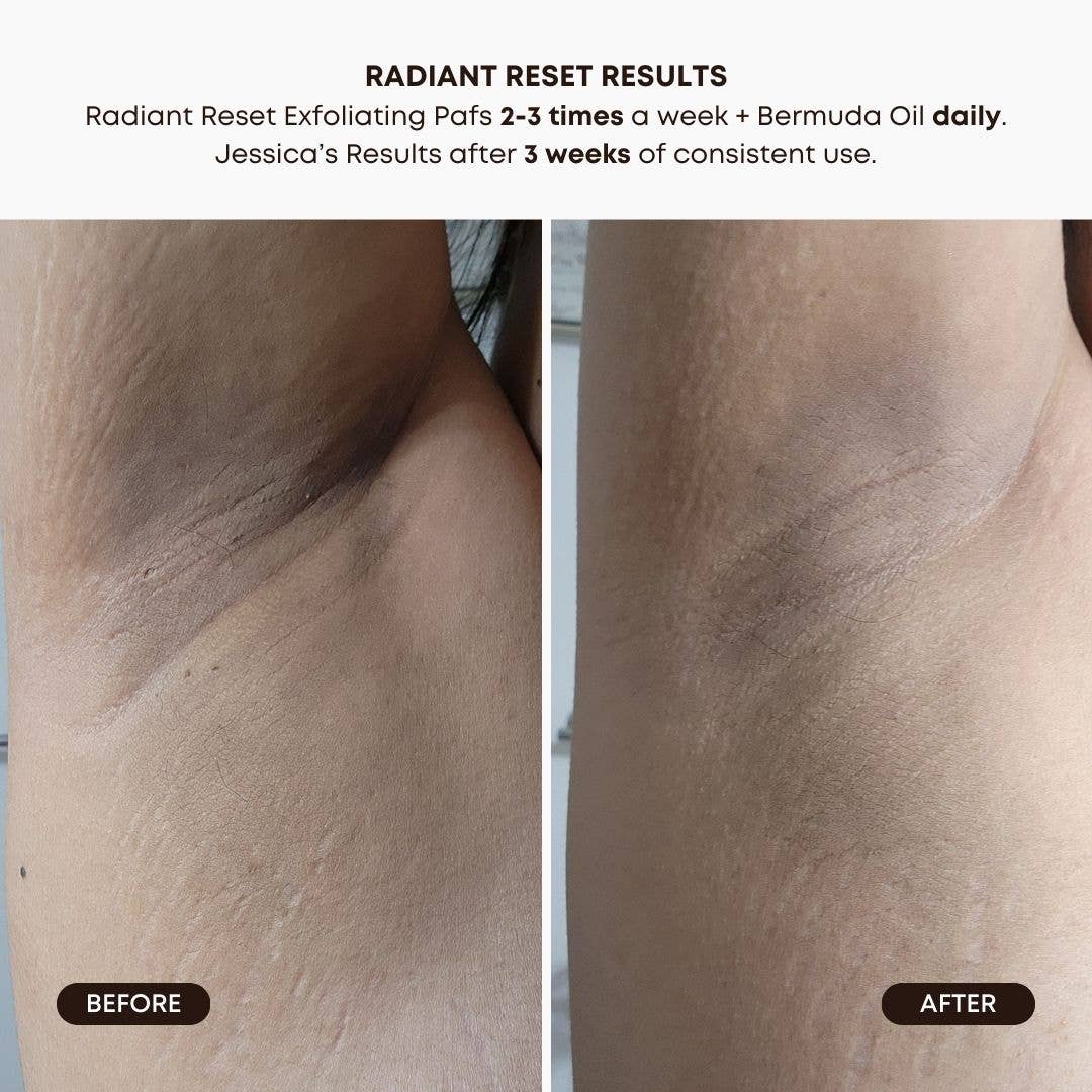Radiant Reset Exfoliating Toner Pads (30)