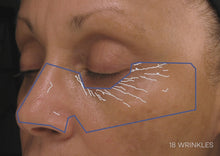 Load and play video in Gallery viewer, LightStim Anti-Aging Device
